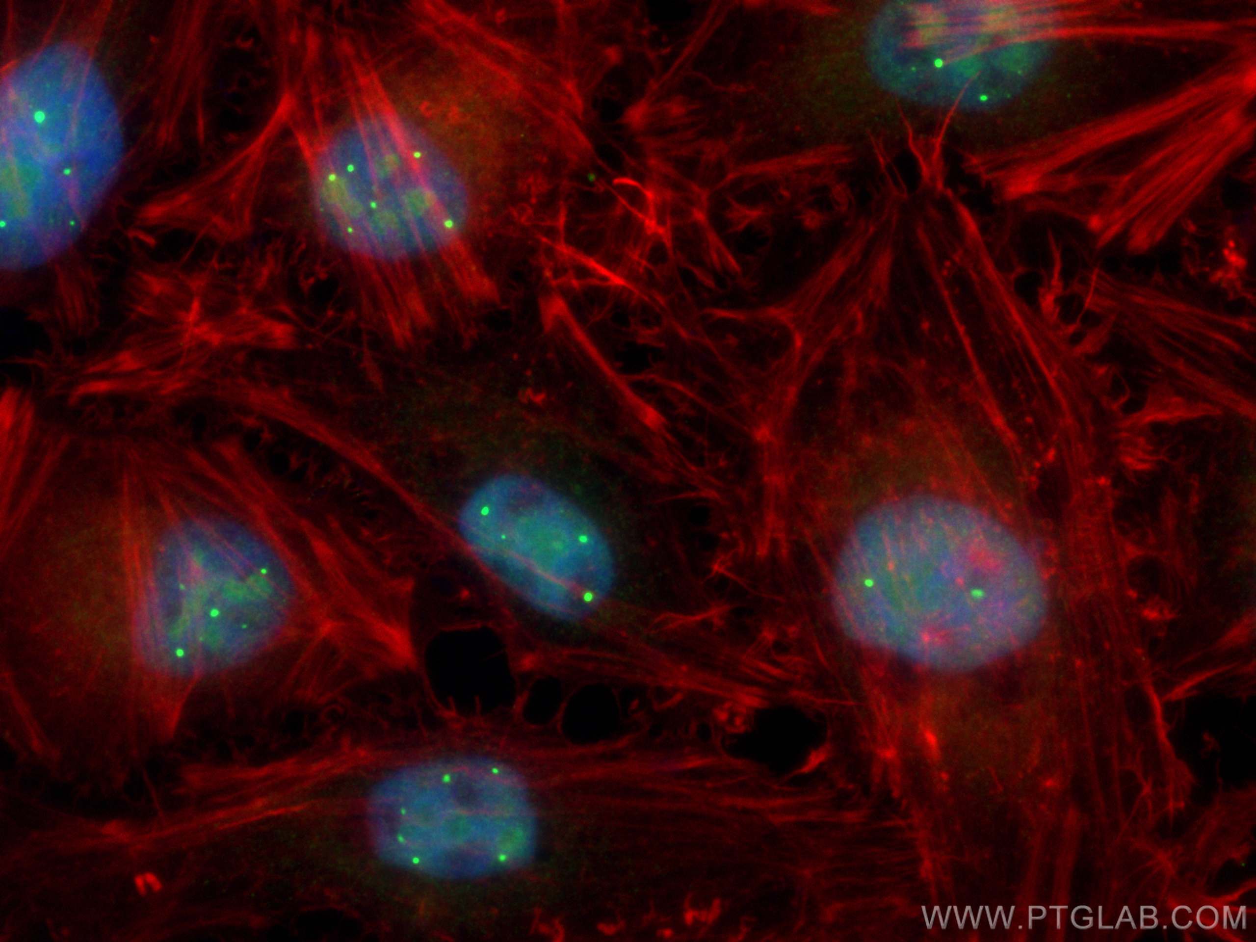 Immunofluorescence (IF) / fluorescent staining of HeLa cells using TOE1 Polyclonal antibody (16203-1-AP)