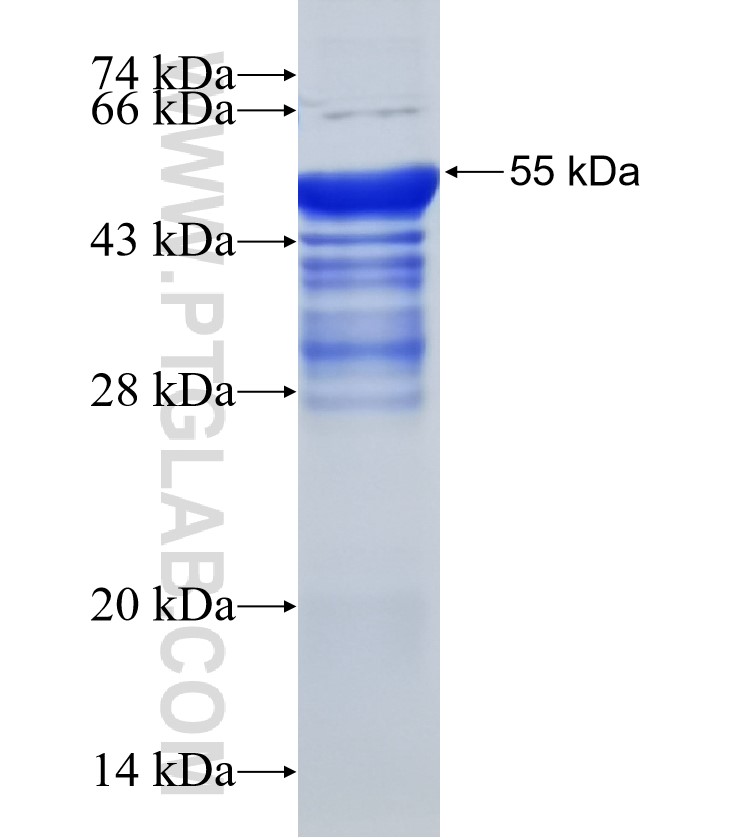 TOE1 fusion protein Ag31470 SDS-PAGE