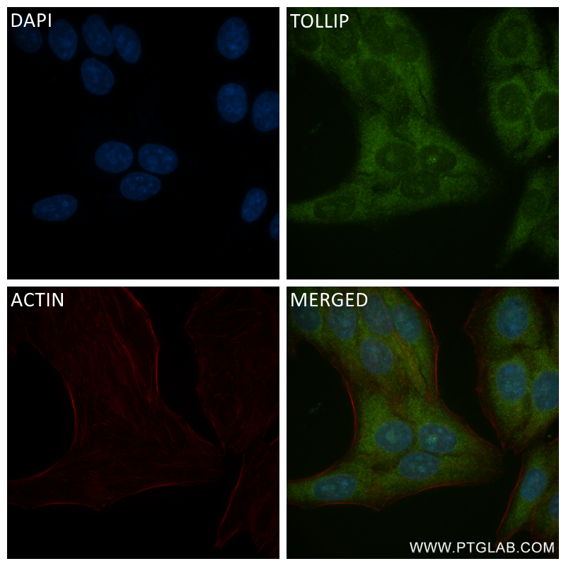 Immunofluorescence (IF) / fluorescent staining of HepG2 cells using TOLLIP Recombinant antibody (84711-5-RR)