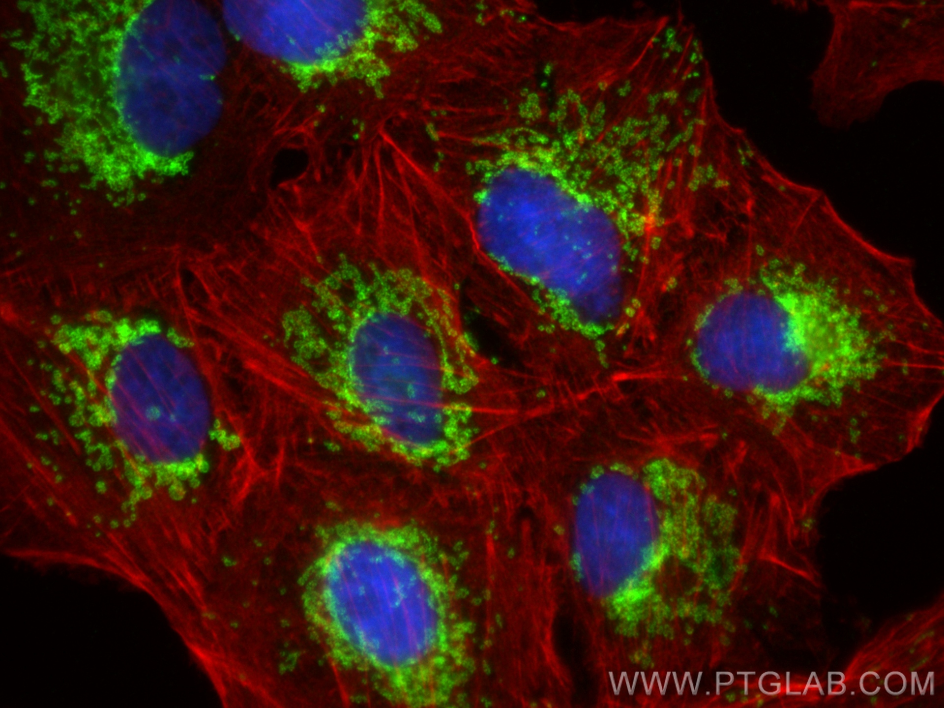 Immunofluorescence (IF) / fluorescent staining of A549 cells using TOM20 Recombinant antibody (80501-1-RR)