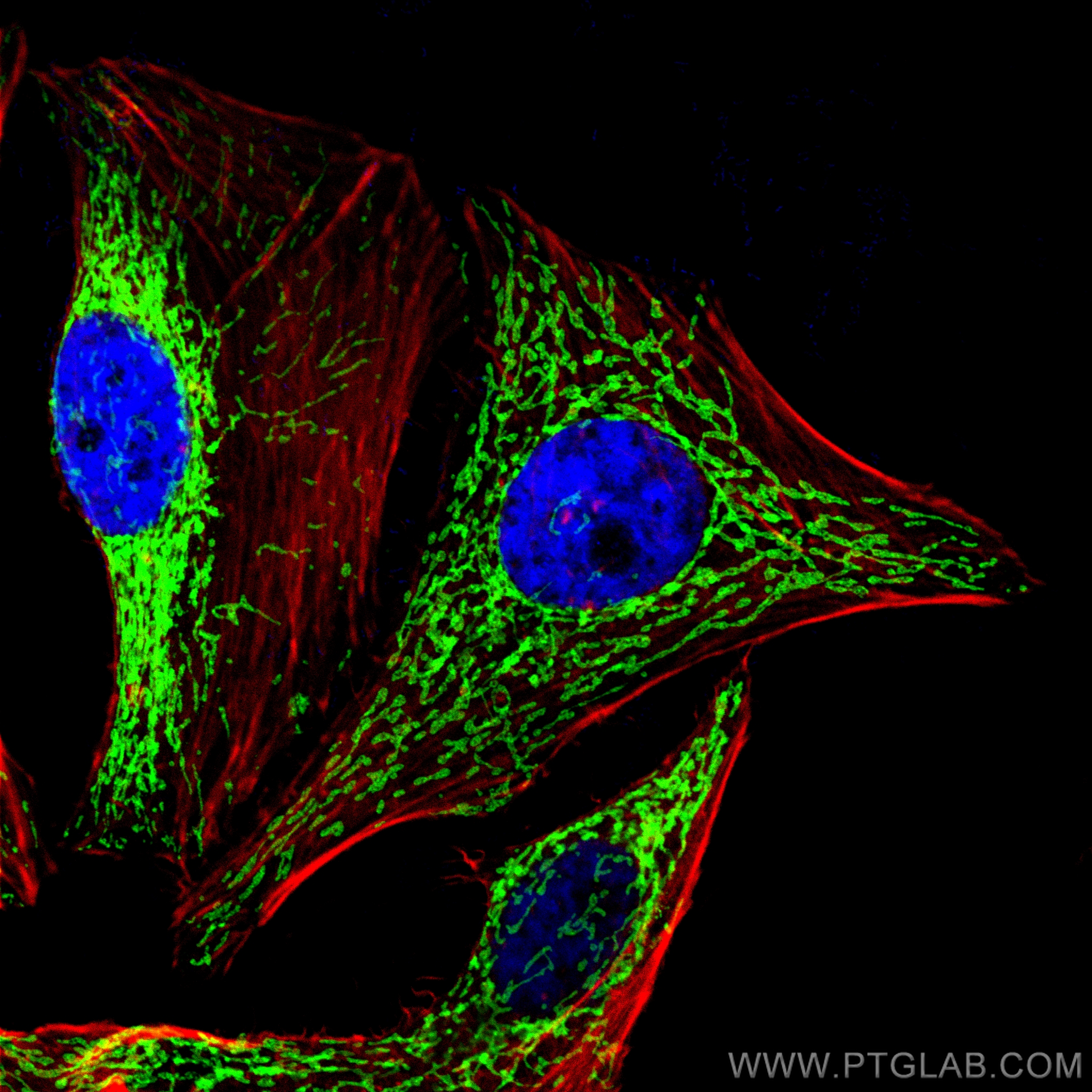 Immunofluorescence (IF) / fluorescent staining of HeLa cells using CoraLite® Plus 488-conjugated TOM20 Recombinant an (CL488-80501)