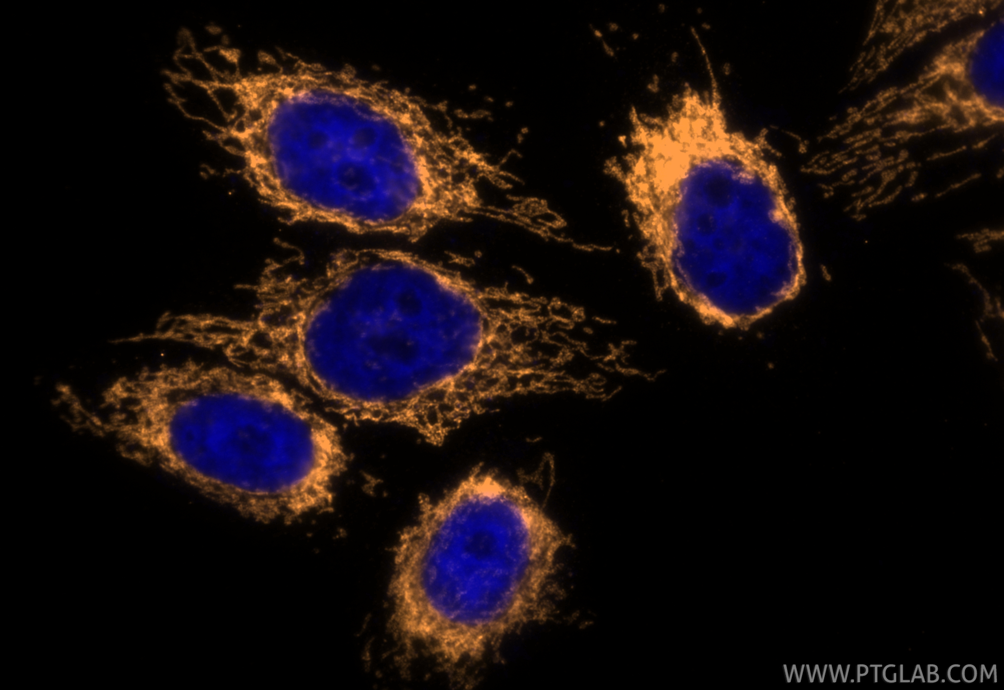 Immunofluorescence (IF) / fluorescent staining of HepG2 cells using CoraLite® Plus 555-conjugated TOM20 Recombinant mo (CL555-80501)
