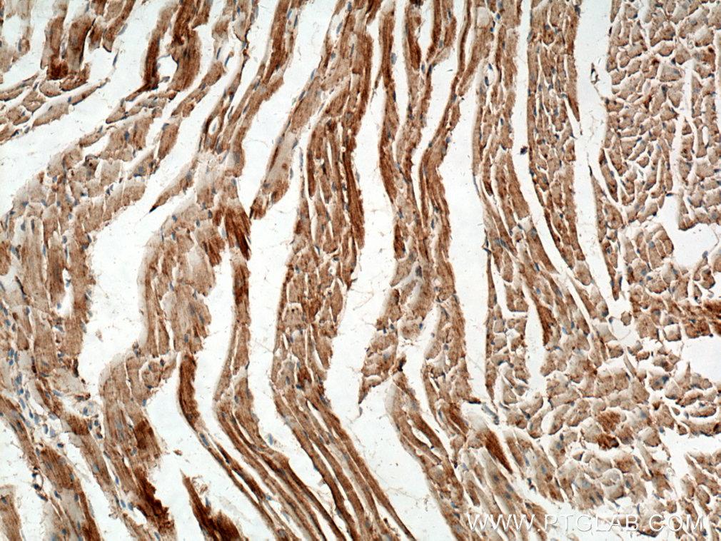 Immunohistochemistry (IHC) staining of mouse heart tissue using TOM70 Polyclonal antibody (14528-1-AP)