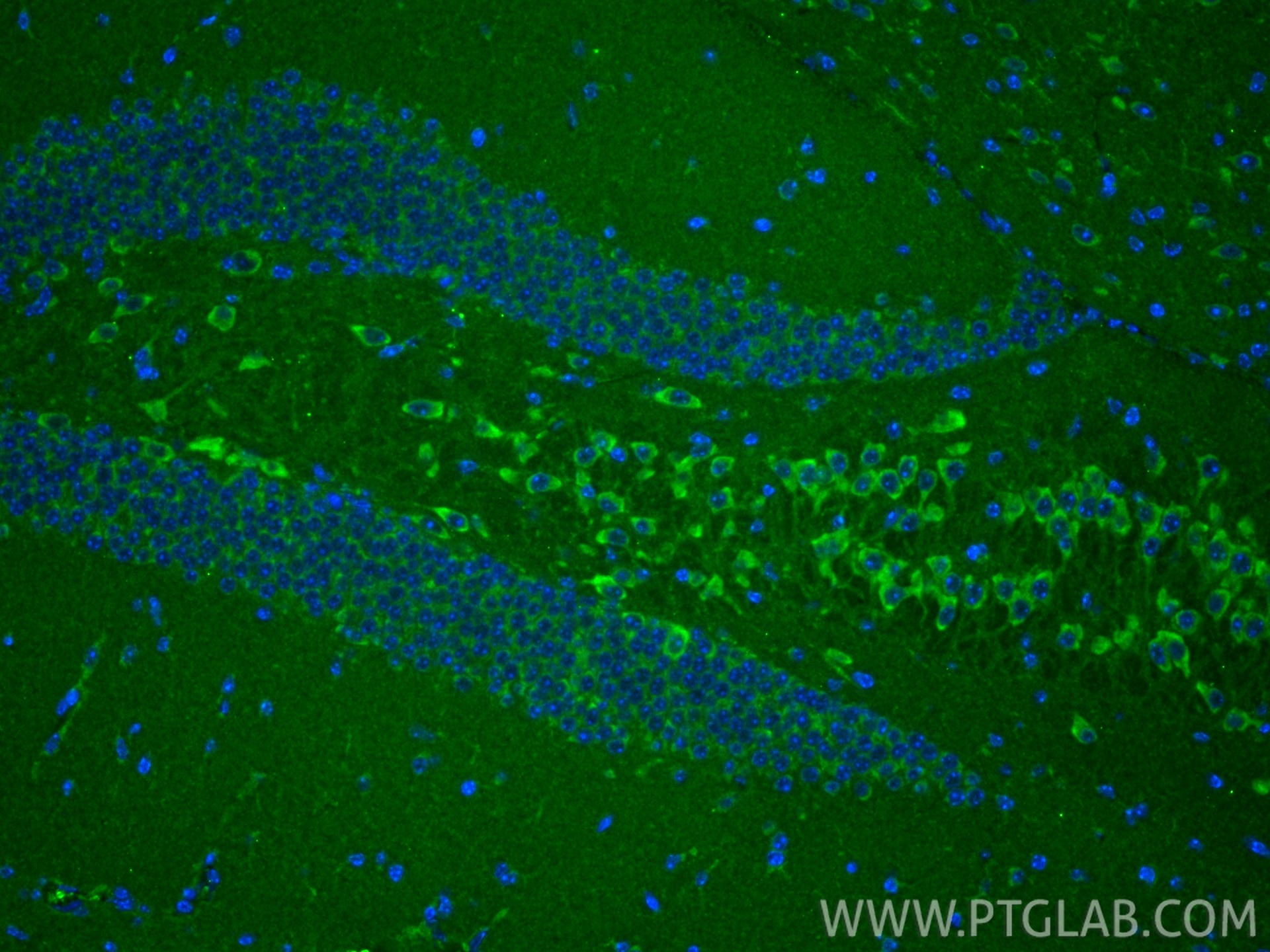 Immunofluorescence (IF) / fluorescent staining of mouse brain tissue using TOMM34 Polyclonal antibody (12196-1-AP)