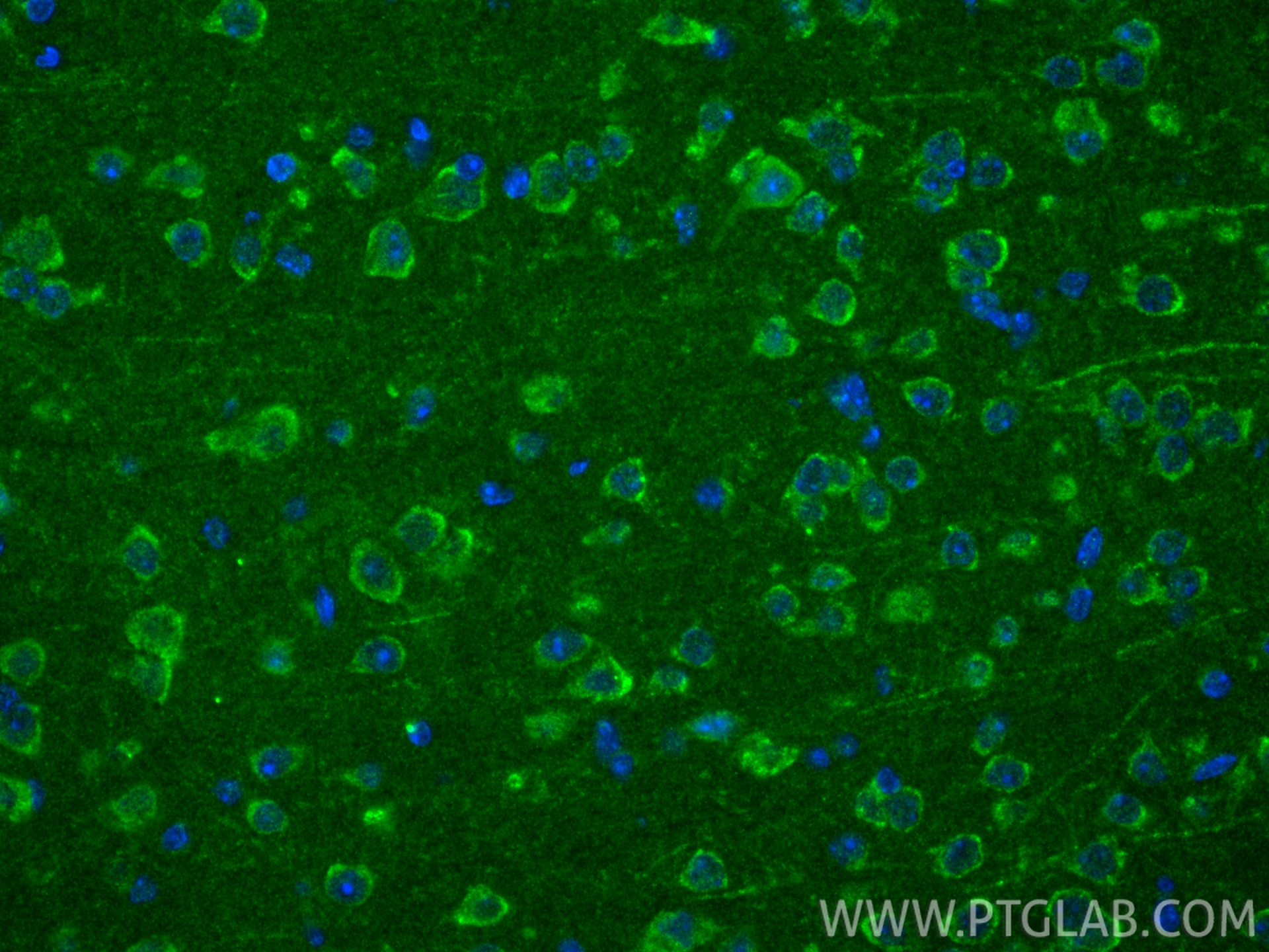 Immunofluorescence (IF) / fluorescent staining of mouse brain tissue using TOMM6 Polyclonal antibody (16689-1-AP)
