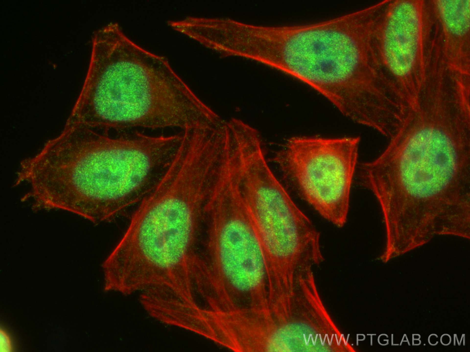 Immunofluorescence (IF) / fluorescent staining of HepG2 cells using TOP1 Polyclonal antibody (20705-1-AP)