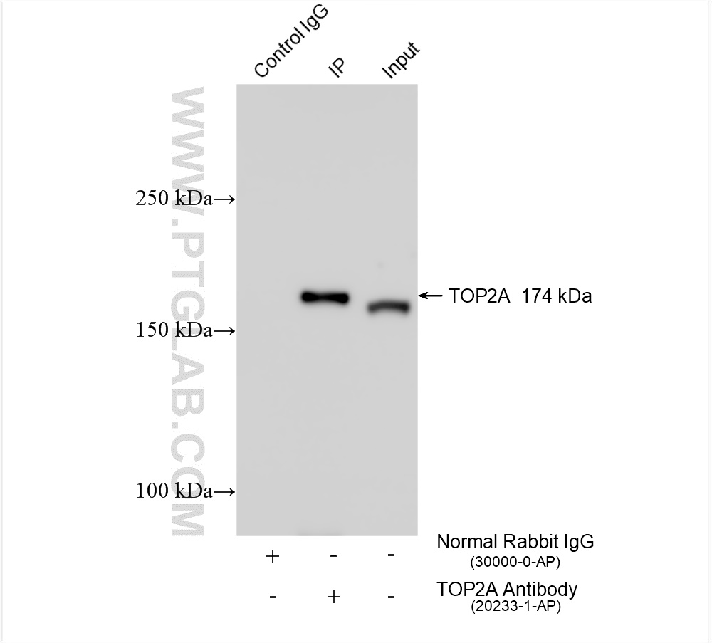 Immunoprecipitation (IP) experiment of L02 cells using TOP2A-Specific Polyclonal antibody (20233-1-AP)