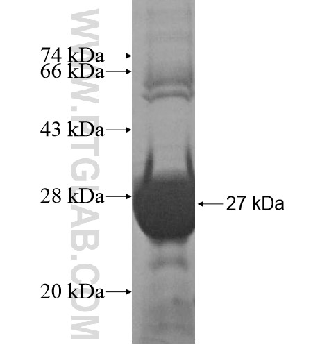 TOP3B fusion protein Ag14336 SDS-PAGE