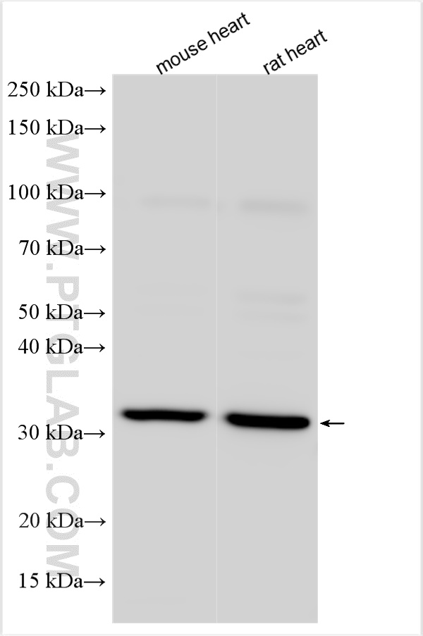 TOR1B