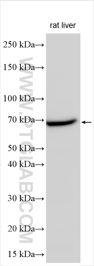 Western Blot (WB) analysis of various lysates using TOX2 Polyclonal antibody (21162-1-AP)