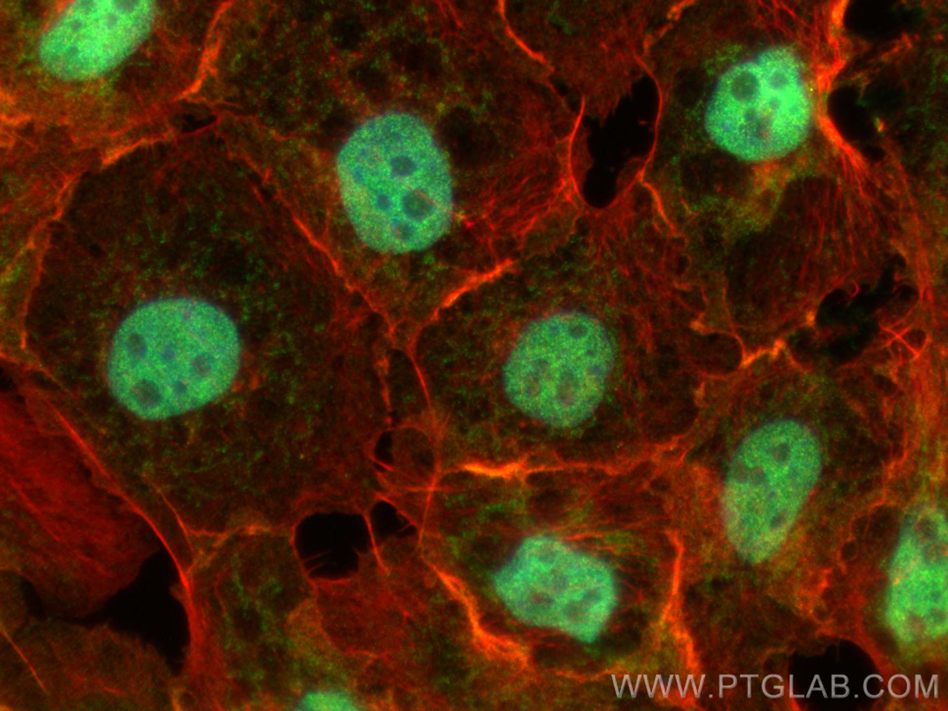 Immunofluorescence (IF) / fluorescent staining of A431 cells using TOX2 Polyclonal antibody (30474-1-AP)