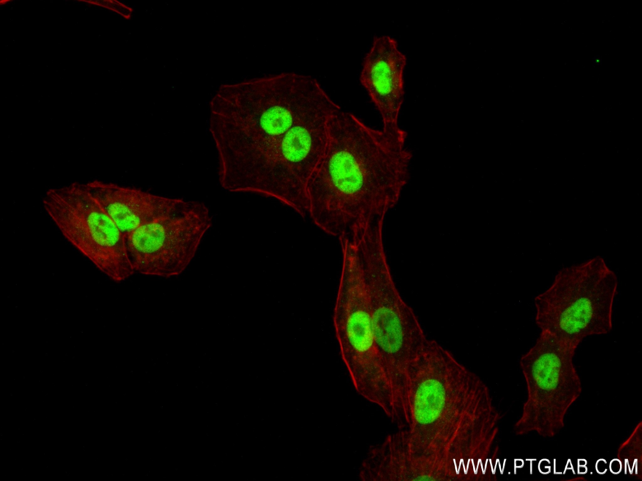 Immunofluorescence (IF) / fluorescent staining of A549 cells using TOX2 Recombinant antibody (84304-2-RR)