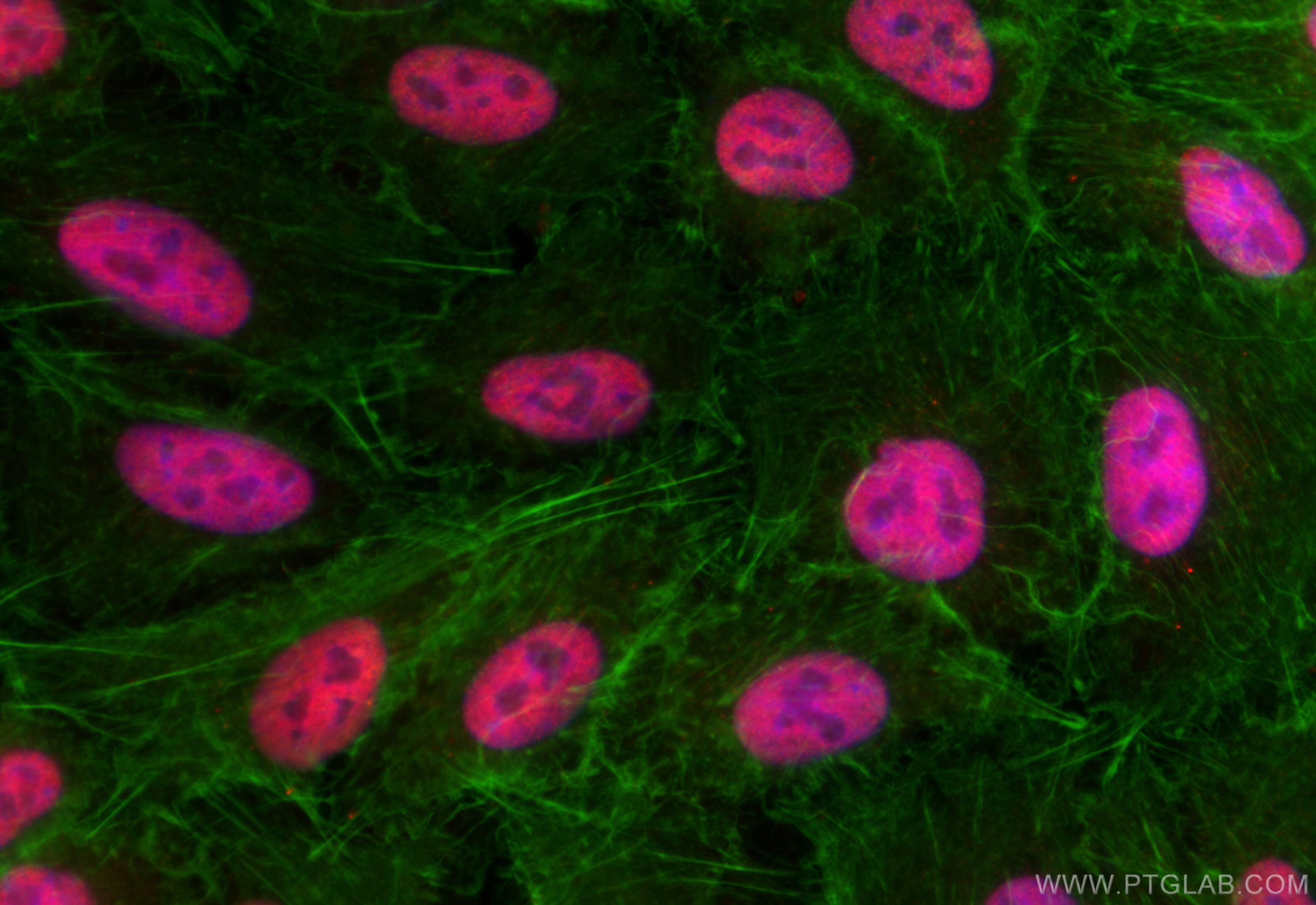 Immunofluorescence (IF) / fluorescent staining of A549 cells using TOX2 Recombinant antibody (84304-2-RR)