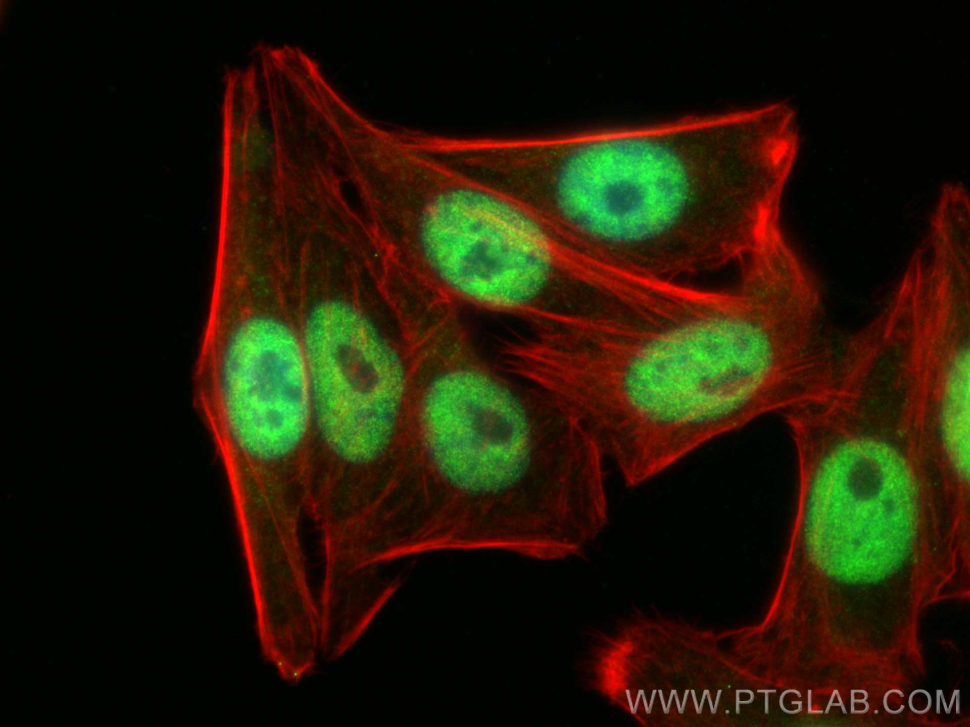 Immunofluorescence (IF) / fluorescent staining of HepG2 cells using TOX4 Polyclonal antibody (27988-1-AP)