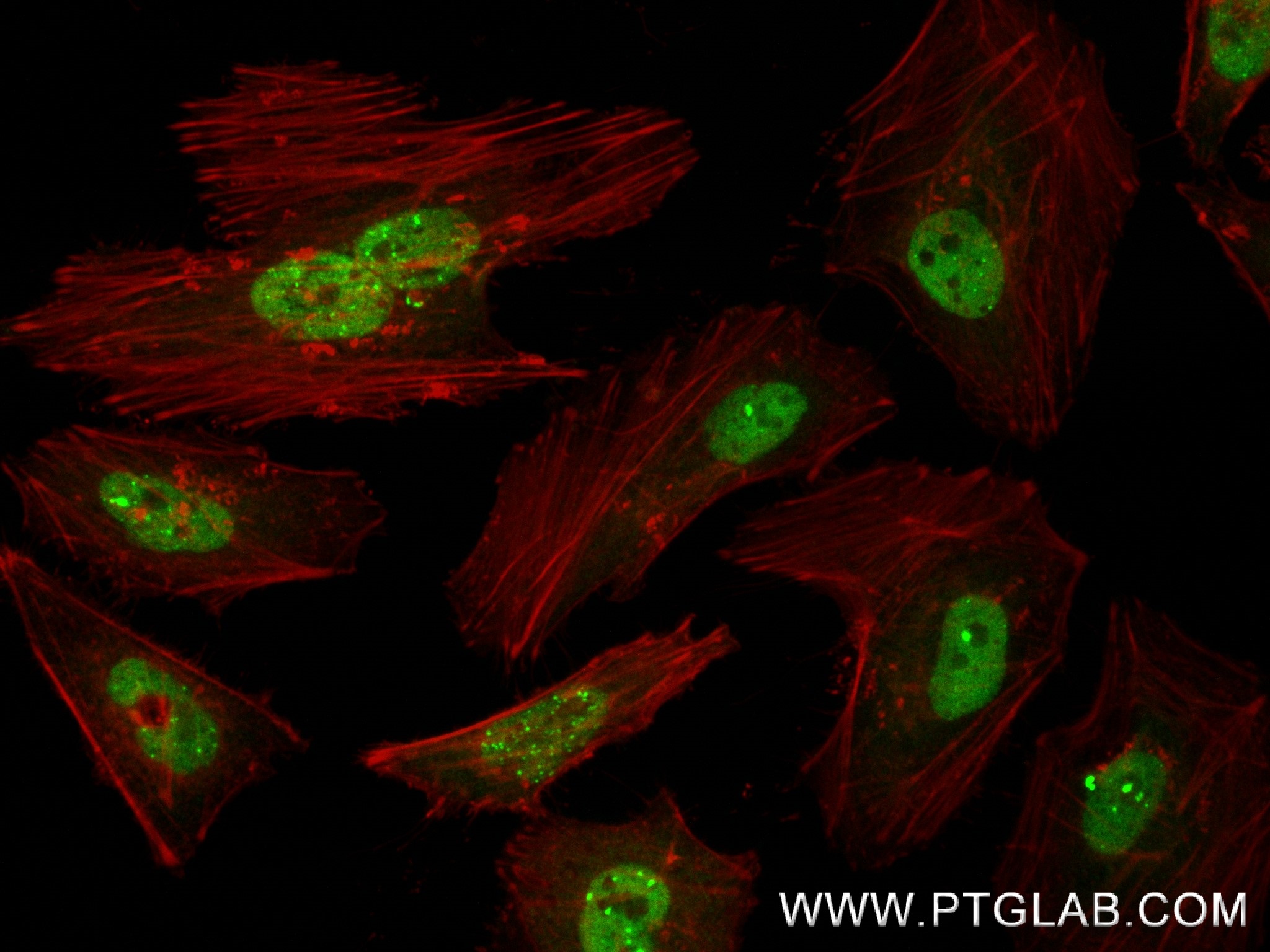 Immunofluorescence (IF) / fluorescent staining of HeLa cells using TP53BP1-Specific Recombinant antibody (83809-1-RR)