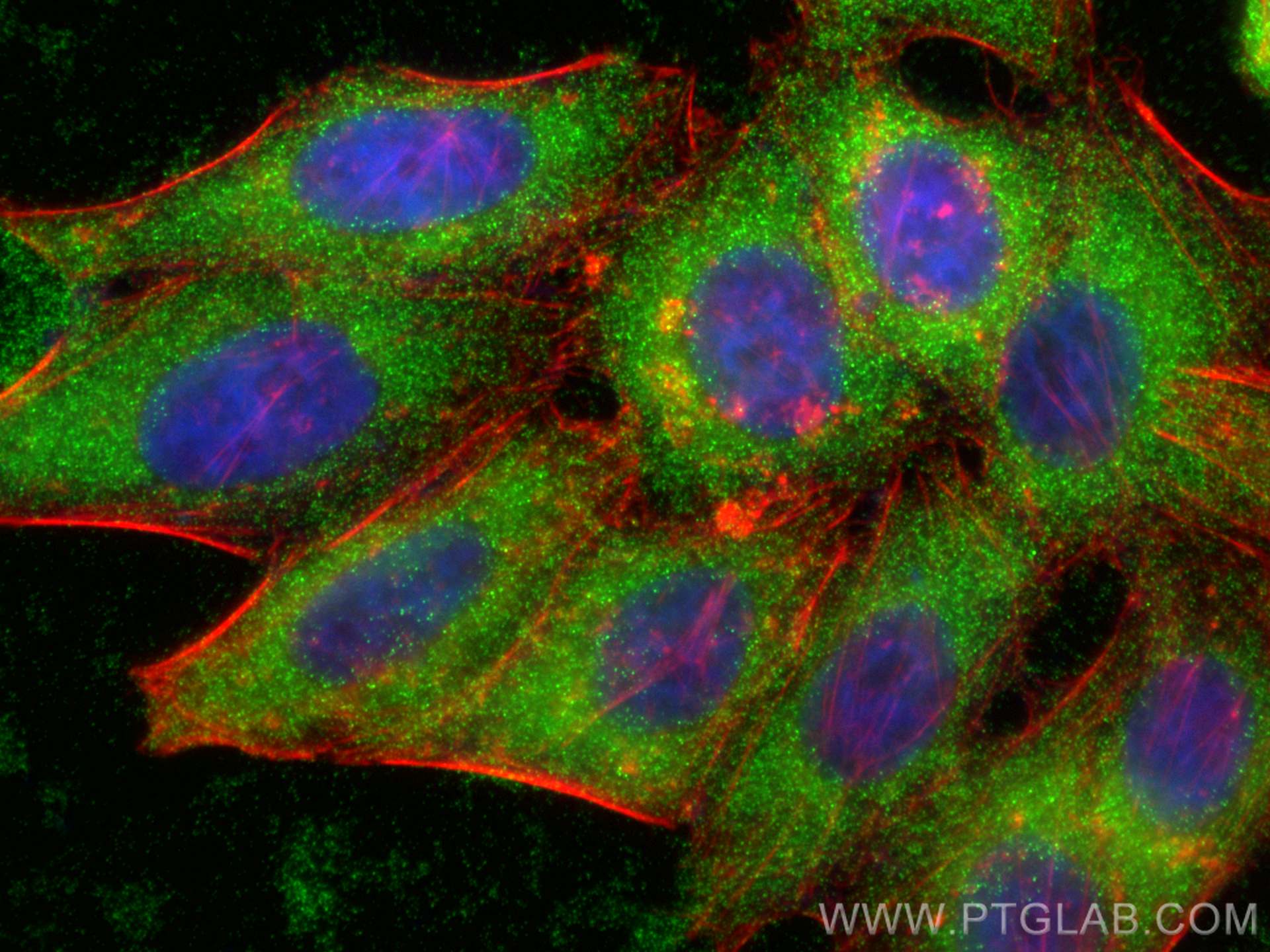 Immunofluorescence (IF) / fluorescent staining of HepG2 cells using PIG3 Polyclonal antibody (14828-1-AP)