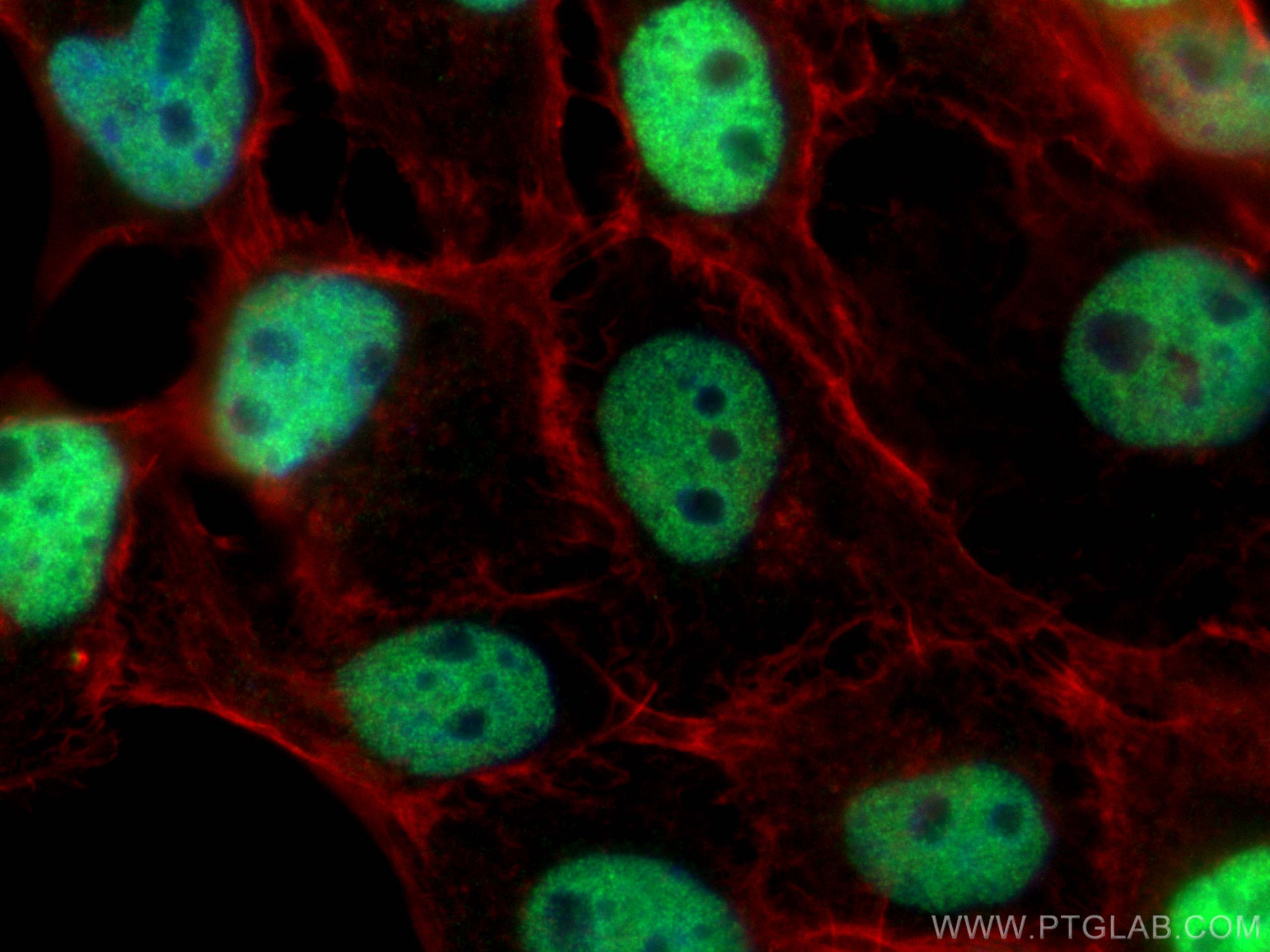 Immunofluorescence (IF) / fluorescent staining of A431 cells using p63 Polyclonal antibody (12143-1-AP)