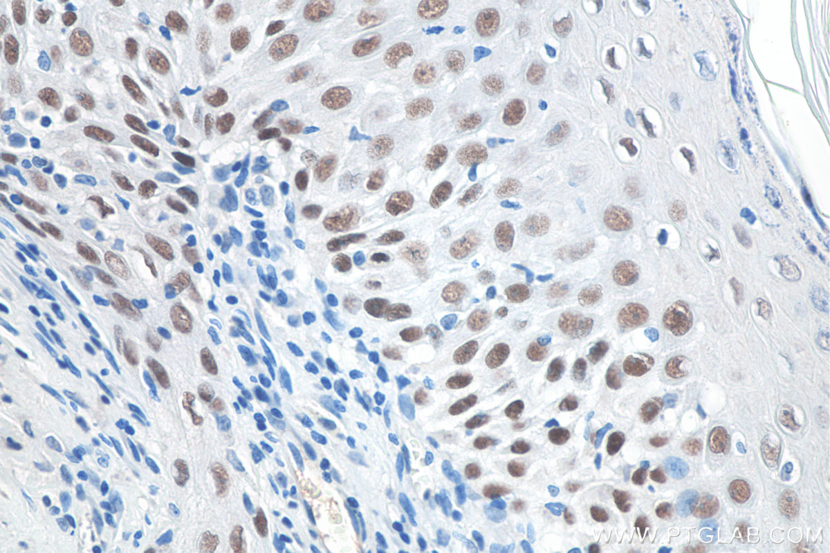 Immunohistochemistry (IHC) staining of rat skin tissue using TP63 Monoclonal antibody (60332-2-Ig)
