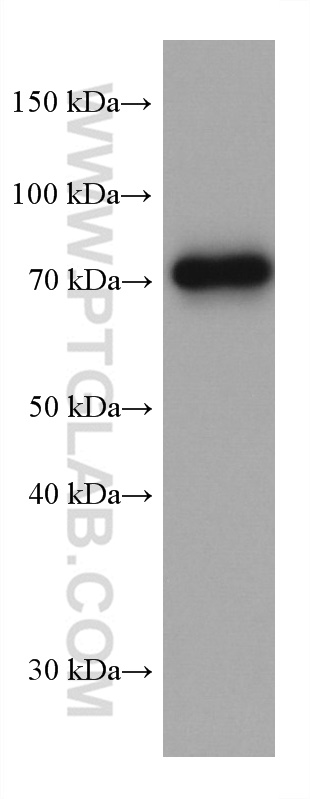 Western Blot (WB) analysis of HaCaT cells using TP63 Monoclonal antibody (60332-2-Ig)