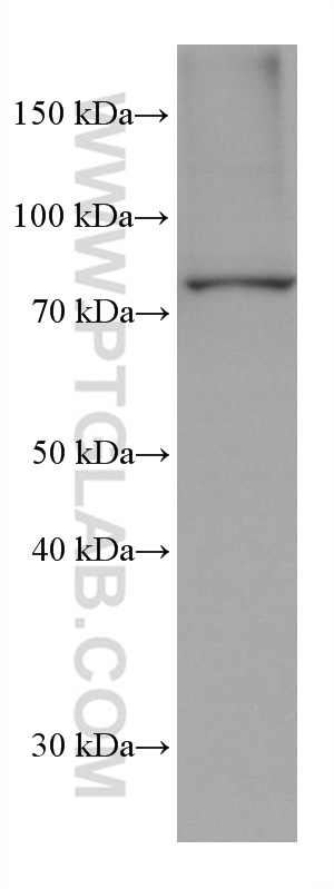 Western Blot (WB) analysis of U-937 cells using TP63 Monoclonal antibody (60332-2-Ig)