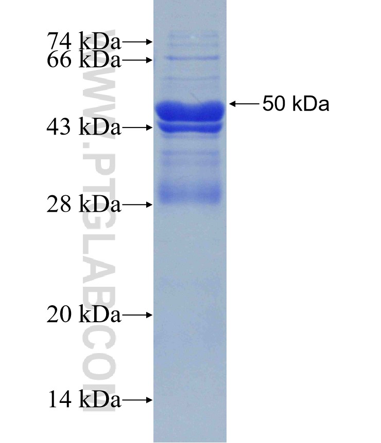 TPBG fusion protein Ag30019 SDS-PAGE