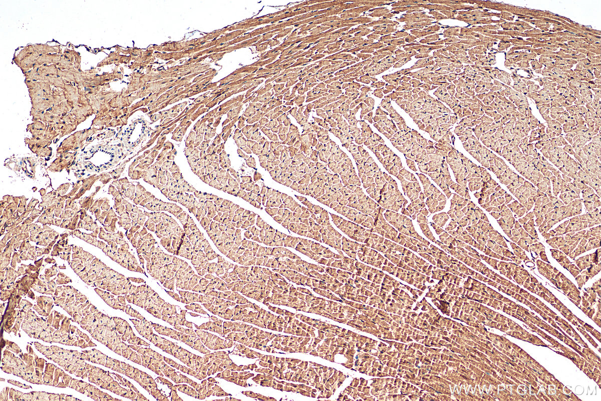 Immunohistochemistry (IHC) staining of mouse heart tissue using TPC1 Polyclonal antibody (23758-1-AP)