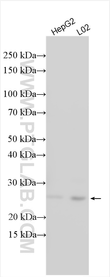 Western Blot (WB) analysis of various lysates using TPD52 Polyclonal antibody (27648-1-AP)