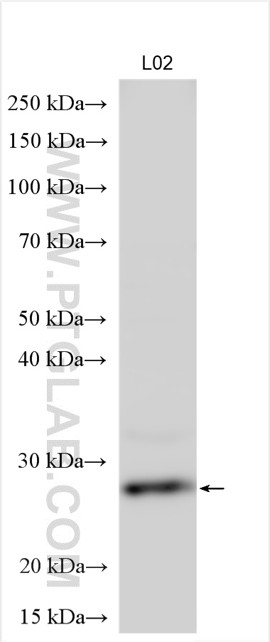 Western Blot (WB) analysis of various lysates using TPD52 Polyclonal antibody (27648-1-AP)