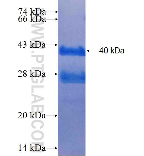 TPD52 fusion protein Ag26503 SDS-PAGE