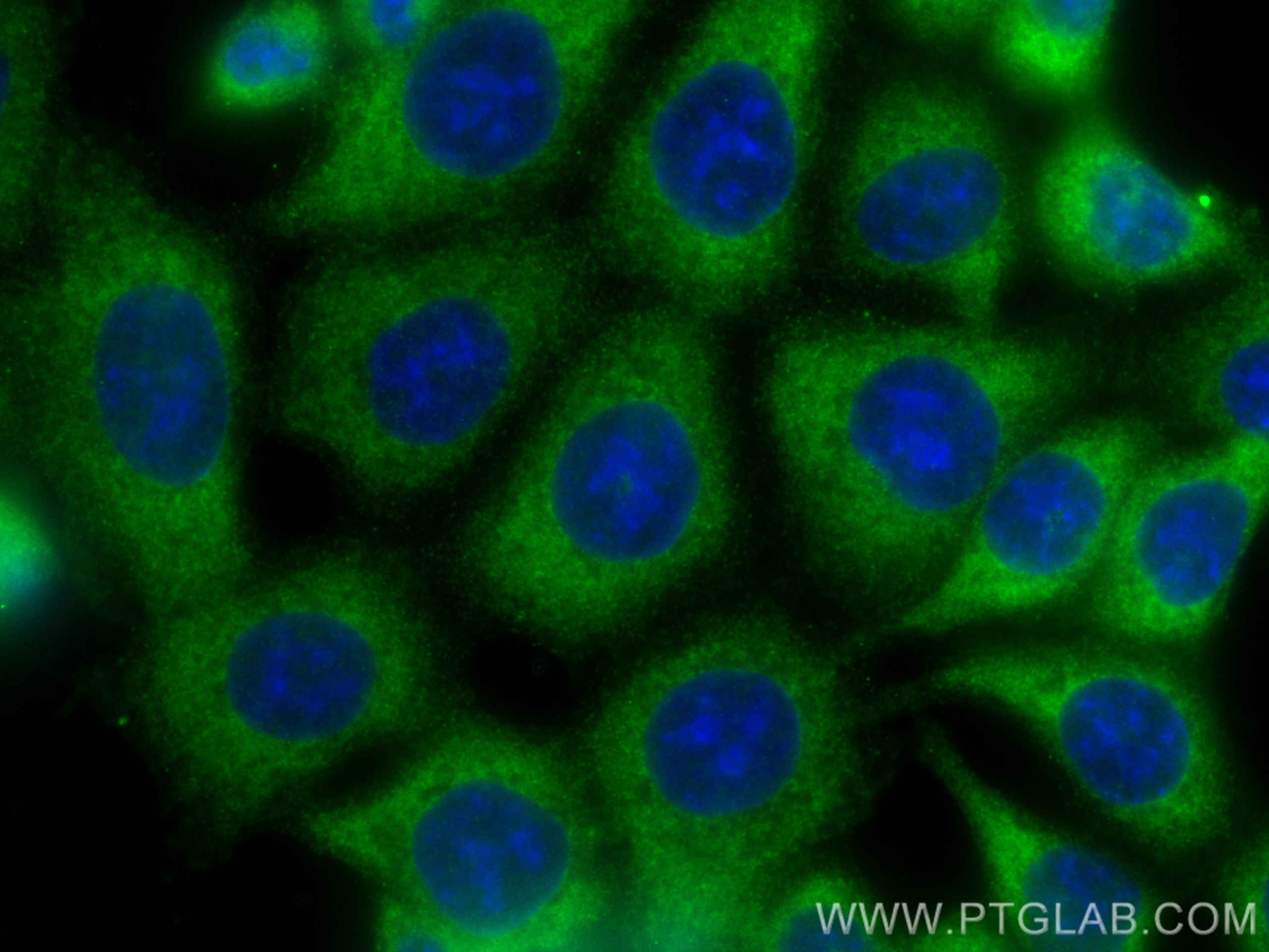 Immunofluorescence (IF) / fluorescent staining of HCT 116 cells using TPD52L2 Monoclonal antibody (68077-1-Ig)