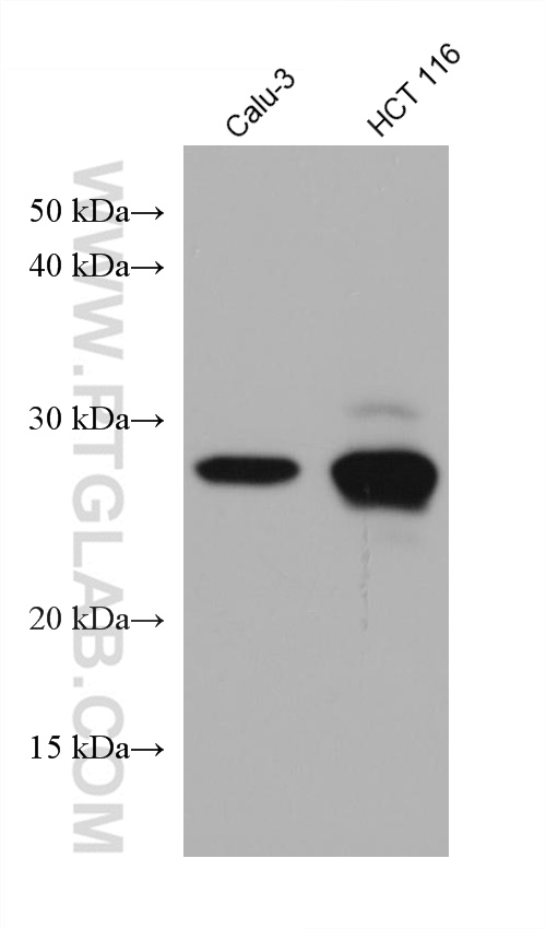 Western Blot (WB) analysis of various lysates using TPD52L2 Monoclonal antibody (68077-1-Ig)