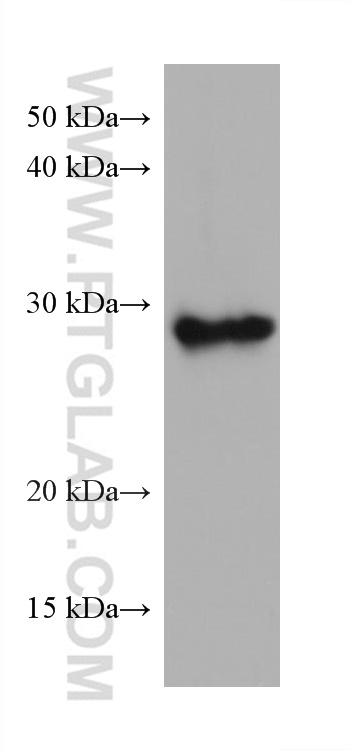 Western Blot (WB) analysis of Neuro-2a cells using TPD52L2 Monoclonal antibody (68077-1-Ig)