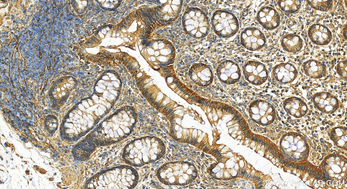 Immunohistochemistry (IHC) staining of human normal colon using TPM1 Polyclonal antibody (28477-1-AP)