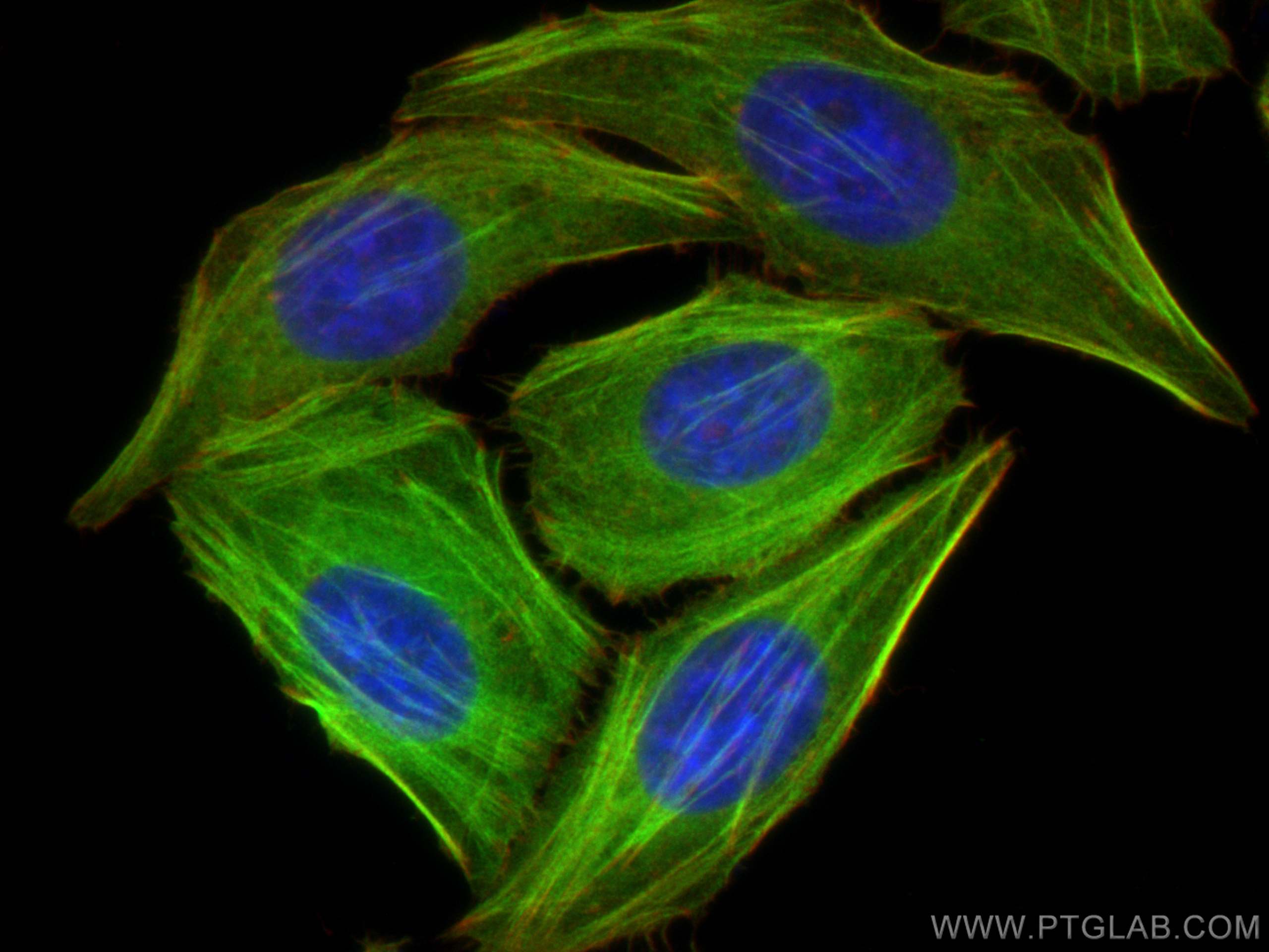 Immunofluorescence (IF) / fluorescent staining of HepG2 cells using TPM2 Polyclonal antibody (11038-1-AP)