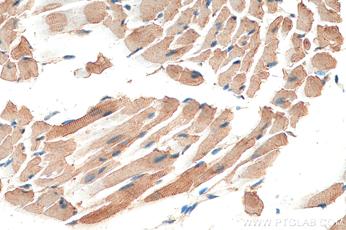 Immunohistochemistry (IHC) staining of mouse heart tissue using TPM2 Polyclonal antibody (11038-1-AP)