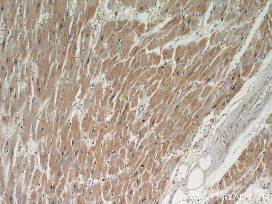 Immunohistochemistry (IHC) staining of human heart tissue using TPM2 Polyclonal antibody (11038-1-AP)