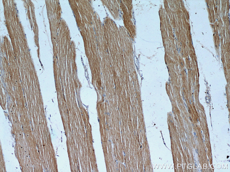 Immunohistochemistry (IHC) staining of human skeletal muscle tissue using TPM2 Polyclonal antibody (11038-1-AP)