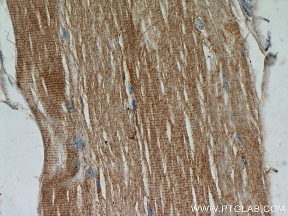 Immunohistochemistry (IHC) staining of human skeletal muscle tissue using TPM2 Polyclonal antibody (11038-1-AP)