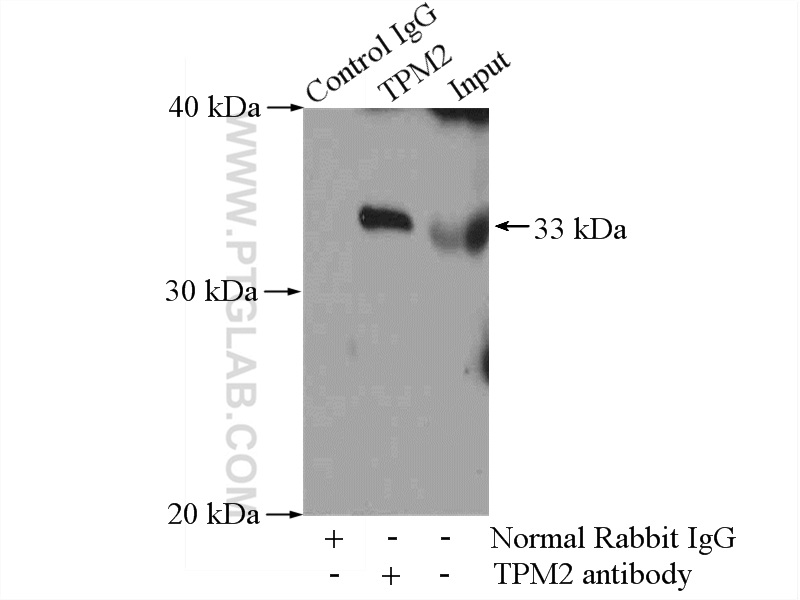 Immunoprecipitation (IP) experiment of mouse skeletal muscle tissue using TPM2 Polyclonal antibody (11038-1-AP)