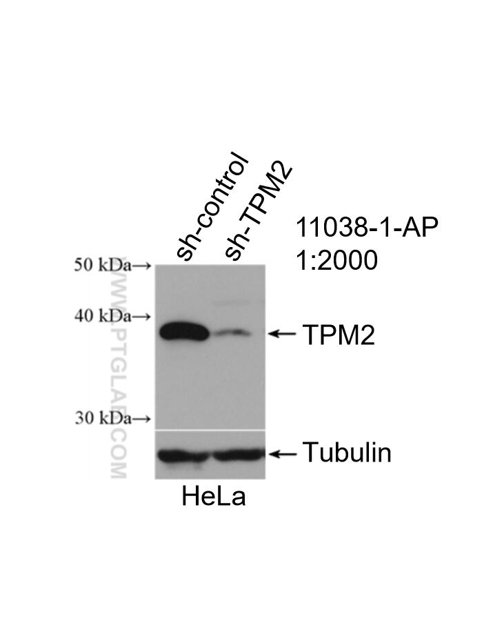 Western Blot (WB) analysis of HeLa cells using TPM2 Polyclonal antibody (11038-1-AP)