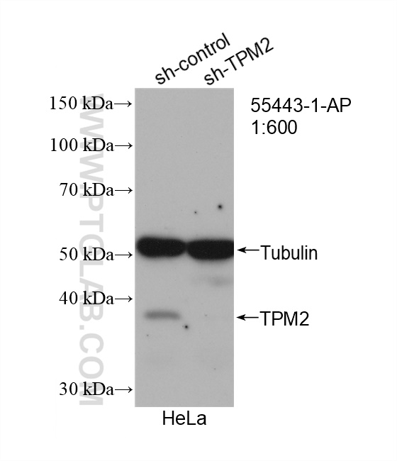 Western Blot (WB) analysis of HeLa cells using TPM2 Polyclonal antibody (55443-1-AP)