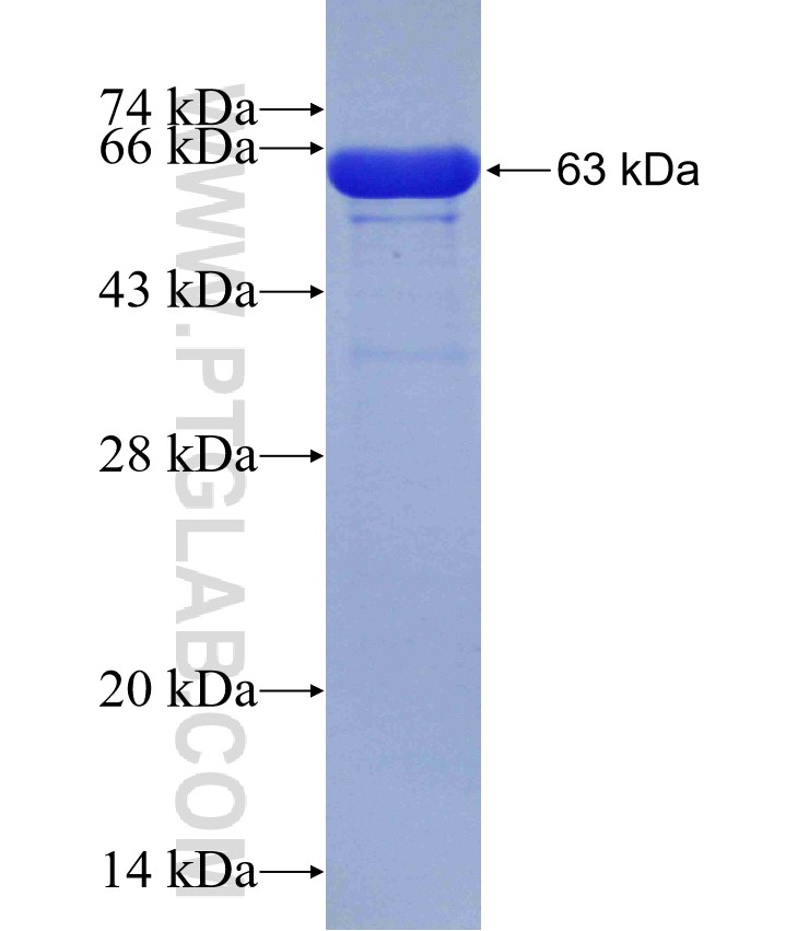 TPM2 fusion protein Ag1508 SDS-PAGE