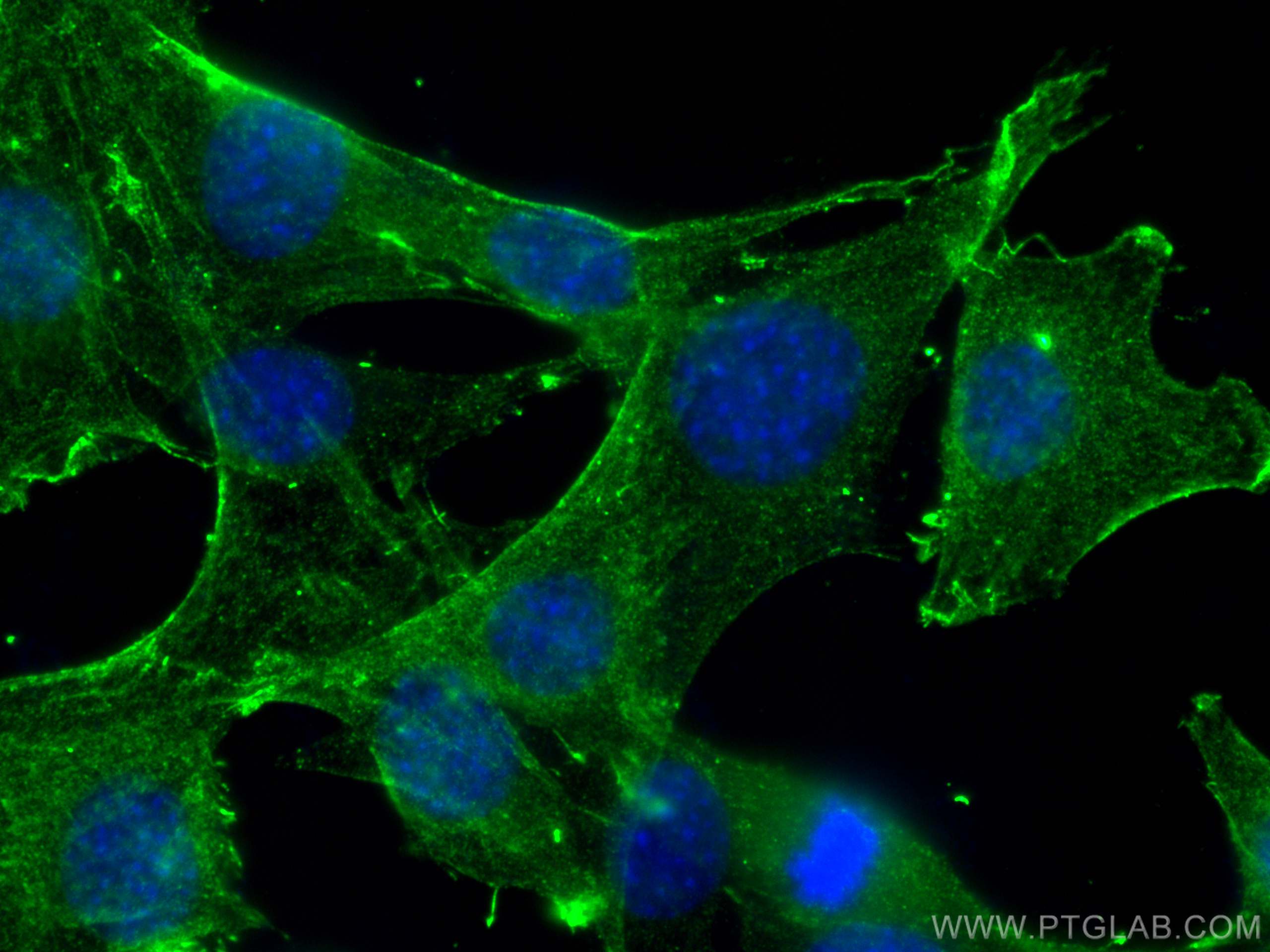 Immunofluorescence (IF) / fluorescent staining of C2C12 cells using TPM3 Monoclonal antibody (68158-1-Ig)