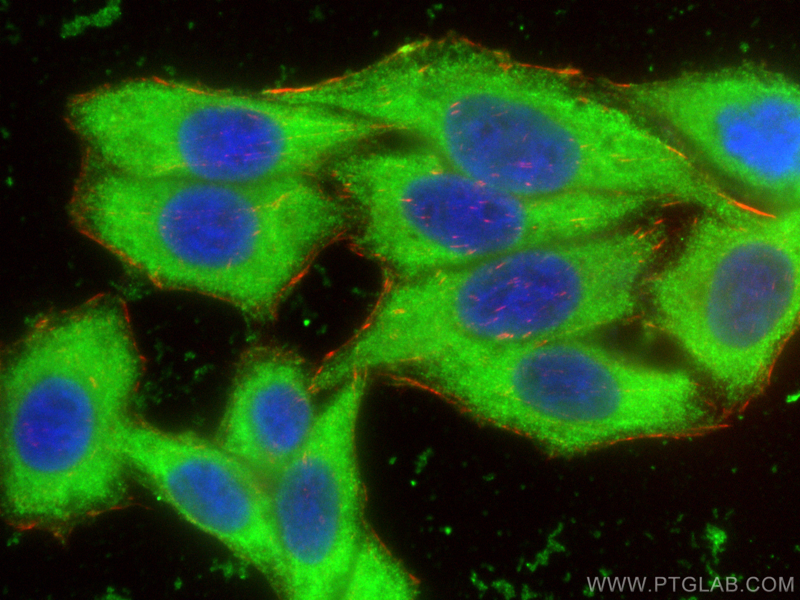 TPMT antibody (68251-1-PBS) | Proteintech