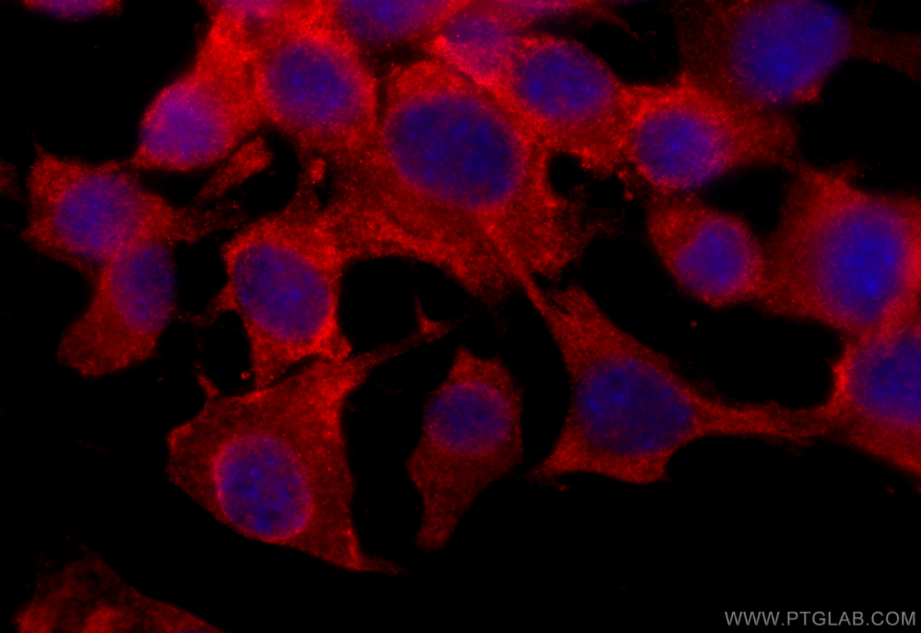 Immunofluorescence (IF) / fluorescent staining of Neuro-2a cells using TPPP Polyclonal antibody (18742-1-AP)