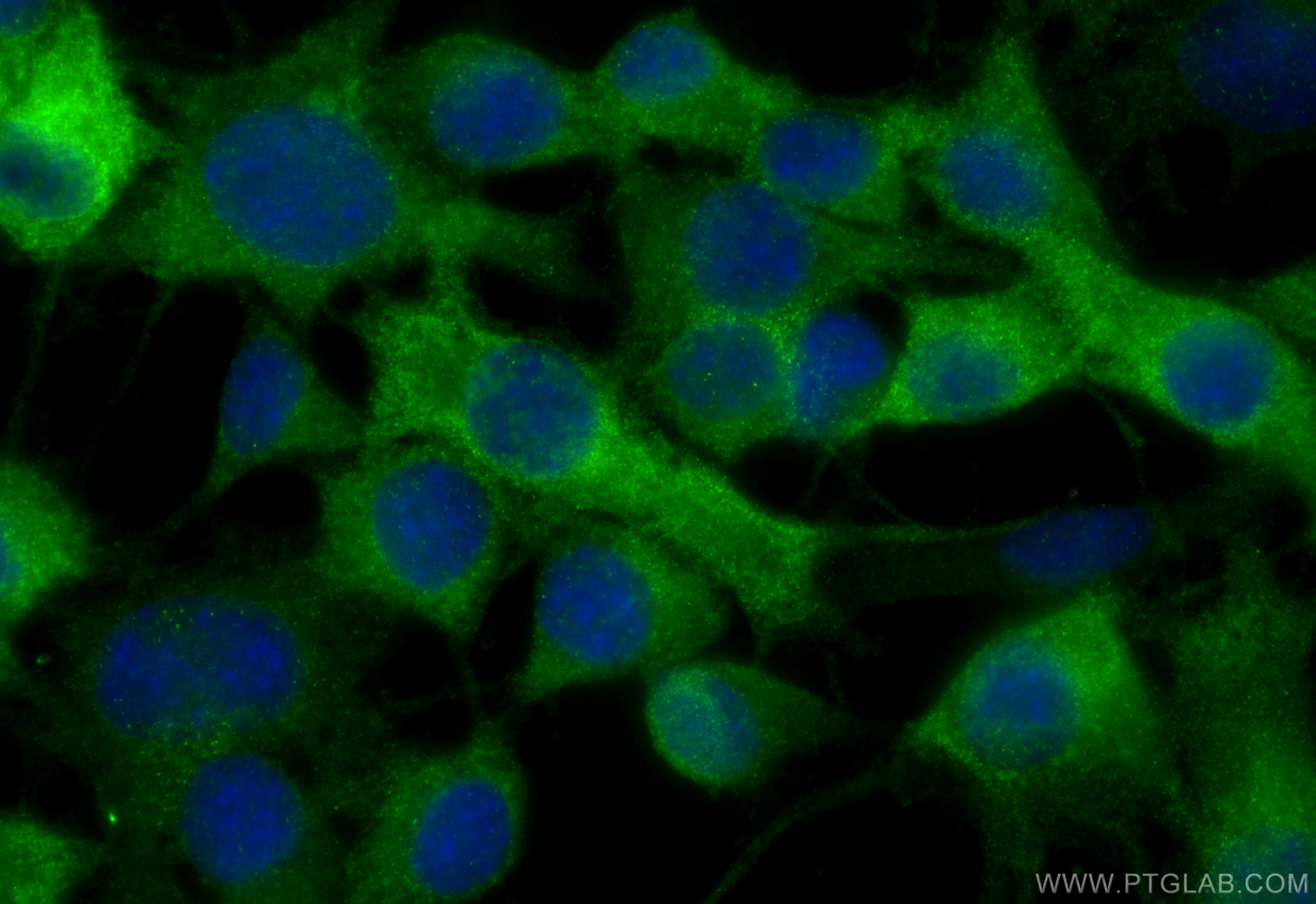 Immunofluorescence (IF) / fluorescent staining of Neuro-2a cells using TPPP Monoclonal antibody (68048-1-Ig)