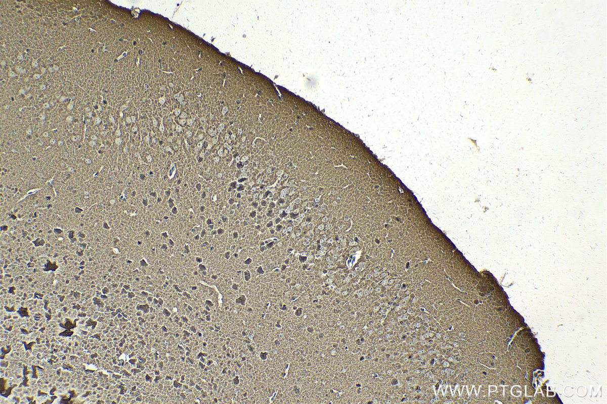 Immunohistochemistry (IHC) staining of mouse brain tissue using TPPP Monoclonal antibody (68048-1-Ig)