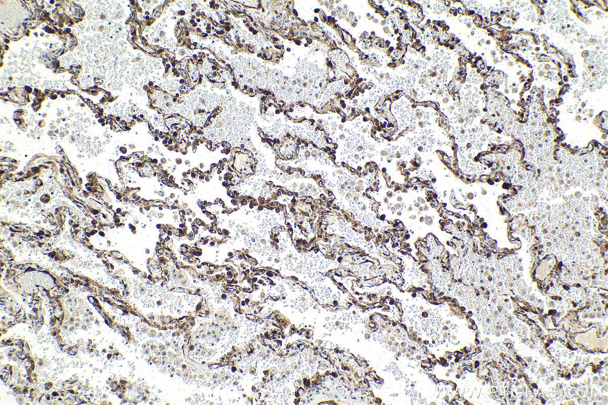 Immunohistochemistry (IHC) staining of human lung tissue using TPPP Monoclonal antibody (68048-1-Ig)