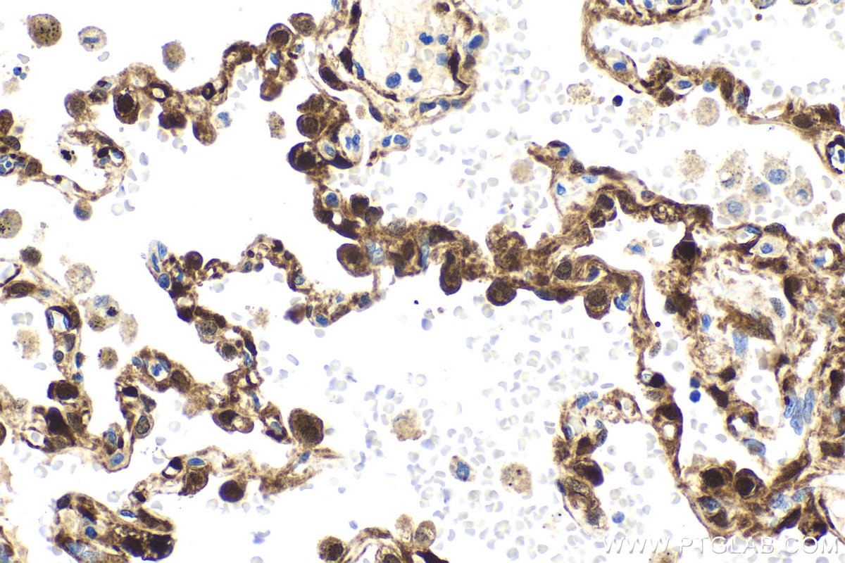 Immunohistochemistry (IHC) staining of human lung tissue using TPPP Monoclonal antibody (68048-1-Ig)