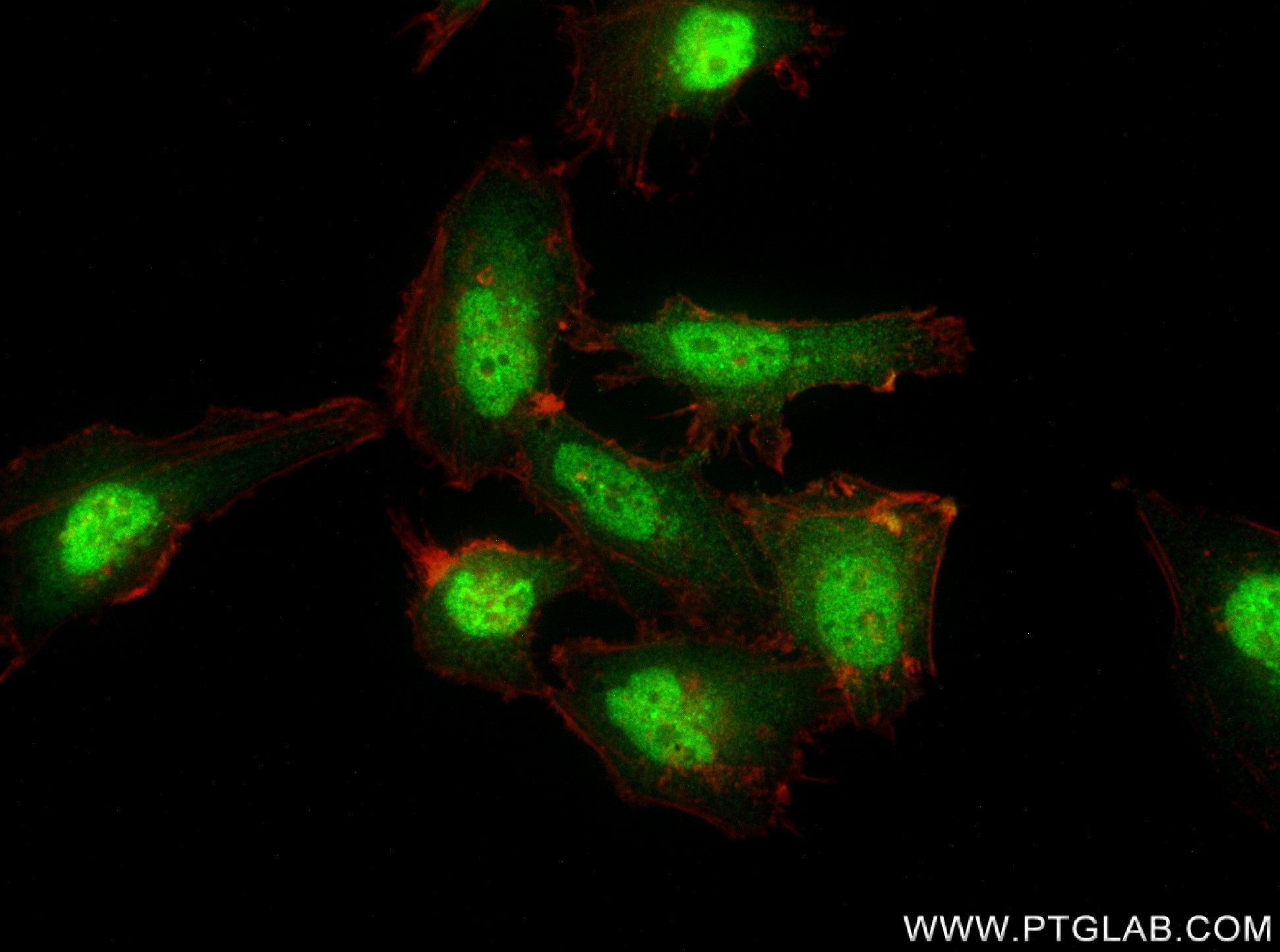 Immunofluorescence (IF) / fluorescent staining of HeLa cells using TPR Recombinant antibody (83177-5-RR)